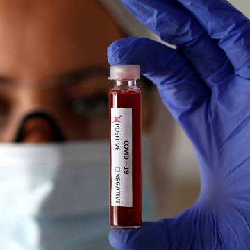 Confirman que el coronavirus tiene preferencia por el grupo sanguíneo A